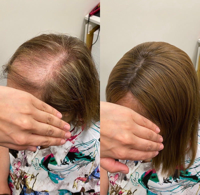 Before & After Photo Gallery – ND Hair Collection